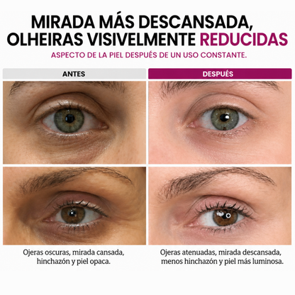 Mejora las líneas de expresión, las manchas y los signos de cansancio de forma natural.
