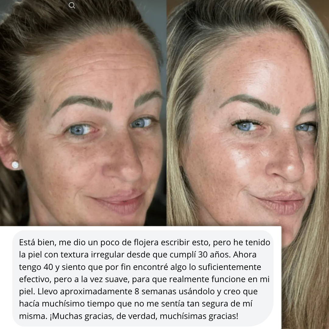 Mejora las líneas de expresión, las manchas y los signos de cansancio de forma natural.