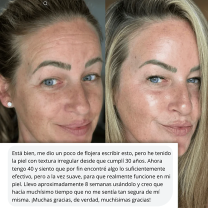 Mejora las líneas de expresión, las manchas y los signos de cansancio de forma natural.