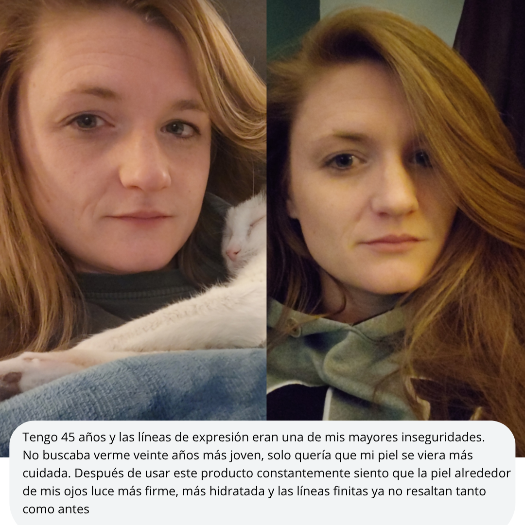 Mejora las líneas de expresión, las manchas y los signos de cansancio de forma natural.